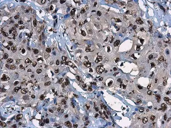 Anti-CDKN2A / p14ARF antibody used in IHC (Paraffin sections) (IHC-P). GTX129902