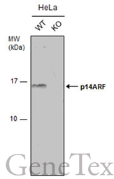 Anti-CDKN2A / p14ARF antibody used in Western Blot (WB). GTX129902