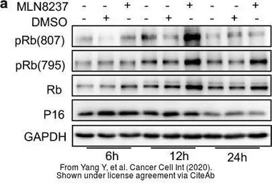 Anti-CDKN2A / p14ARF antibody used in Western Blot (WB). GTX129903