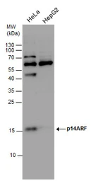 Anti-CDKN2A / p14ARF antibody used in Western Blot (WB). GTX129903