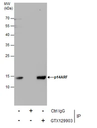 Anti-CDKN2A / p14ARF antibody used in Immunoprecipitation (IP). GTX129903