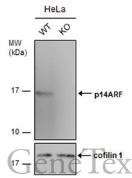 Anti-CDKN2A / p14ARF antibody used in Western Blot (WB). GTX129903