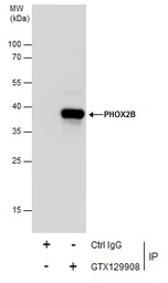Anti-PHOX2B antibody used in Immunoprecipitation (IP). GTX129908