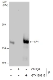 Anti-SA1 antibody used in Immunoprecipitation (IP). GTX129912
