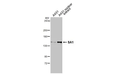 Anti-SA1 antibody used in Western Blot (WB). GTX129912