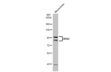 Anti-OPA1 antibody used in Western Blot (WB). GTX129917