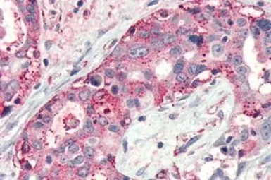 Anti-Frizzled 4 antibody used in IHC (Paraffin sections) (IHC-P). GTX12992