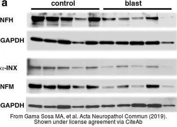 Anti-alpha Internexin antibody used in Western Blot (WB). GTX130053