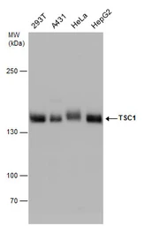 Anti-Hamartin / TSC1 antibody used in Western Blot (WB). GTX130062