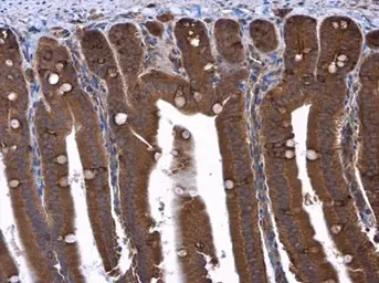 Anti-Hamartin / TSC1 antibody used in IHC (Paraffin sections) (IHC-P). GTX130062