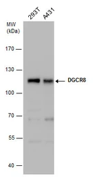 Anti-DGCR8 antibody used in Western Blot (WB). GTX130076
