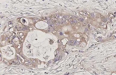 Anti-ADAM9 antibody used in IHC (Paraffin sections) (IHC-P). GTX130081