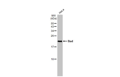Anti-Bad antibody used in Western Blot (WB). GTX130108