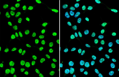 Anti-SUZ12 antibody used in Immunocytochemistry/ Immunofluorescence (ICC/IF). GTX130179