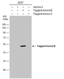 Anti-Aurora B antibody used in Western Blot (WB). GTX130211