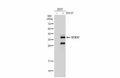 Anti-STX17 antibody used in Western Blot (WB). GTX130212