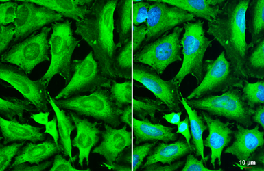 Anti-STX17 antibody used in Immunocytochemistry/ Immunofluorescence (ICC/IF). GTX130212