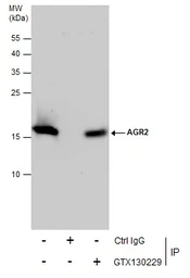 Anti-Anterior Gradient 2 antibody used in Immunoprecipitation (IP). GTX130229