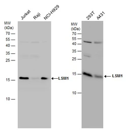 Anti-LSM1 antibody used in Western Blot (WB). GTX130240