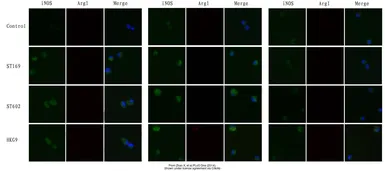Anti-iNOS antibody used in Immunocytochemistry/ Immunofluorescence (ICC/IF). GTX130246