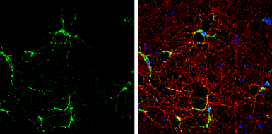 Anti-iNOS antibody used in Immunocytochemistry/ Immunofluorescence (ICC/IF). GTX130246