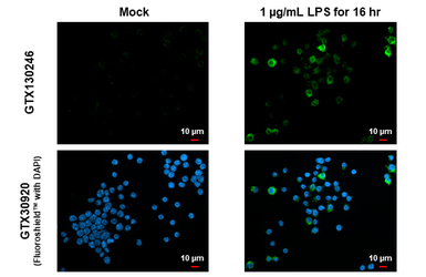 Anti-iNOS antibody used in Immunocytochemistry/ Immunofluorescence (ICC/IF). GTX130246