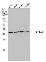 Anti-GNPDA2 antibody used in Western Blot (WB). GTX130289