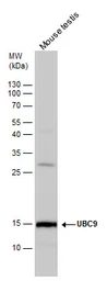 Anti-UBE2I antibody used in Western Blot (WB). GTX130355