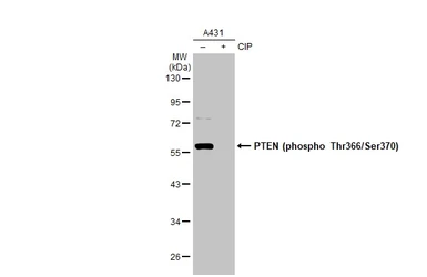 Anti-PTEN (phospho Thr366/Ser370) antibody used in Western Blot (WB). GTX130418