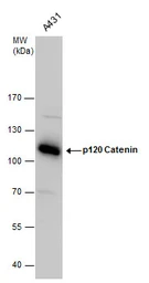 Anti-p120 Catenin antibody used in Western Blot (WB). GTX130448