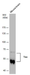 Anti-Tau antibody used in Western Blot (WB). GTX130462