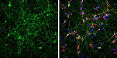Anti-Tau antibody used in Immunocytochemistry/ Immunofluorescence (ICC/IF). GTX130462