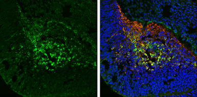 Anti-Tau antibody used in IHC (Frozen sections) (IHC-Fr). GTX130462
