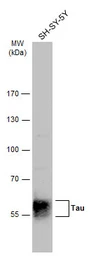 Anti-Tau antibody used in Western Blot (WB). GTX130462