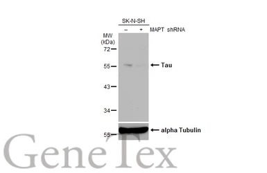 Anti-Tau antibody used in Western Blot (WB). GTX130462