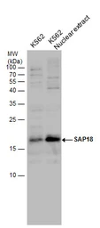 Anti-SAP18 antibody used in Western Blot (WB). GTX130522