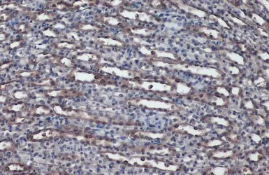 Anti-ACE antibody used in IHC (Paraffin sections) (IHC-P). GTX130534