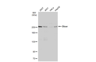 Anti-Dicer antibody used in Western Blot (WB). GTX130536