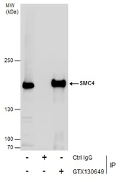 Anti-SMC4 antibody used in Immunoprecipitation (IP). GTX130649