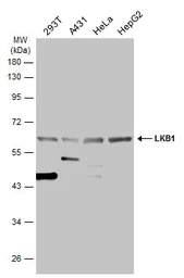 Anti-LKB1 antibody used in Western Blot (WB). GTX130697