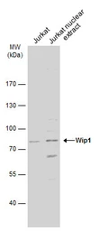 Anti-Wip1 antibody used in Western Blot (WB). GTX130700