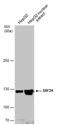 Anti-SNF2H antibody used in Western Blot (WB). GTX130794