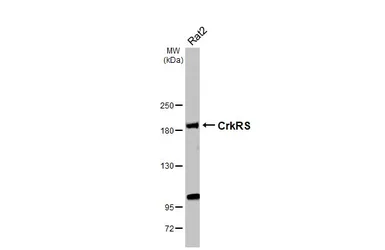 Anti-CDK12 antibody used in Western Blot (WB). GTX130809