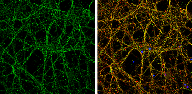 Anti-Nectin 1 antibody used in Immunocytochemistry/ Immunofluorescence (ICC/IF). GTX130824