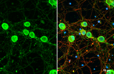 Anti-Nectin 1 antibody used in Immunocytochemistry/ Immunofluorescence (ICC/IF). GTX130824