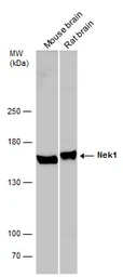 Anti-Nek1 antibody used in Western Blot (WB). GTX130828