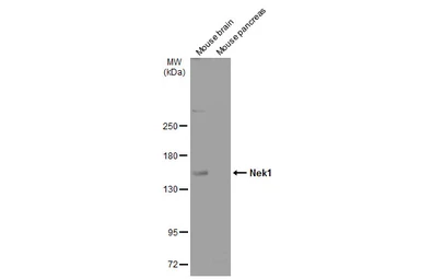 Anti-Nek1 antibody used in Western Blot (WB). GTX130828