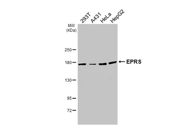 Anti-EPRS antibody used in Western Blot (WB). GTX130848
