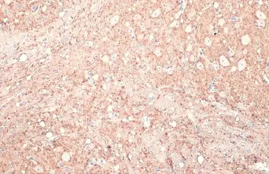Anti-Calbindin antibody used in IHC (Paraffin sections) (IHC-P). GTX130856