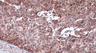 Anti-IRS4 antibody used in IHC (Paraffin sections) (IHC-P). GTX130865